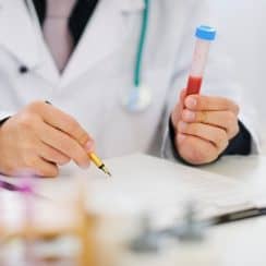 xét nghiệm máu tổng quát, xét nghiệm máu bao nhiêu tiền