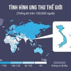 Phần lớn nguyên nhân ung thư do chế độ ăn uống